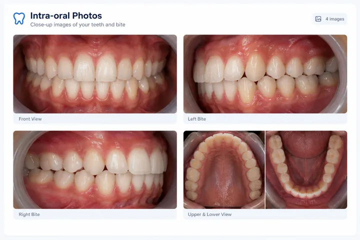Intra-oral photos (demo)