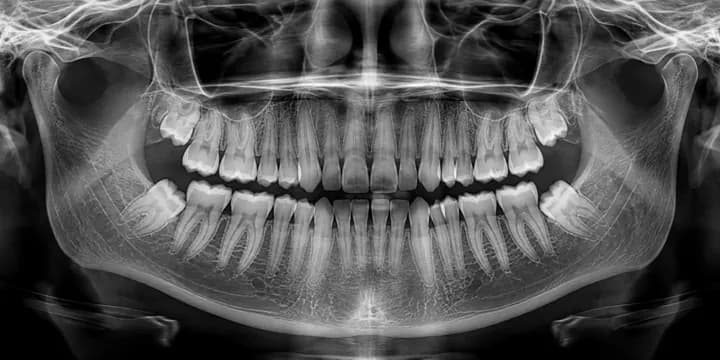 Panoramic X-ray (demo)